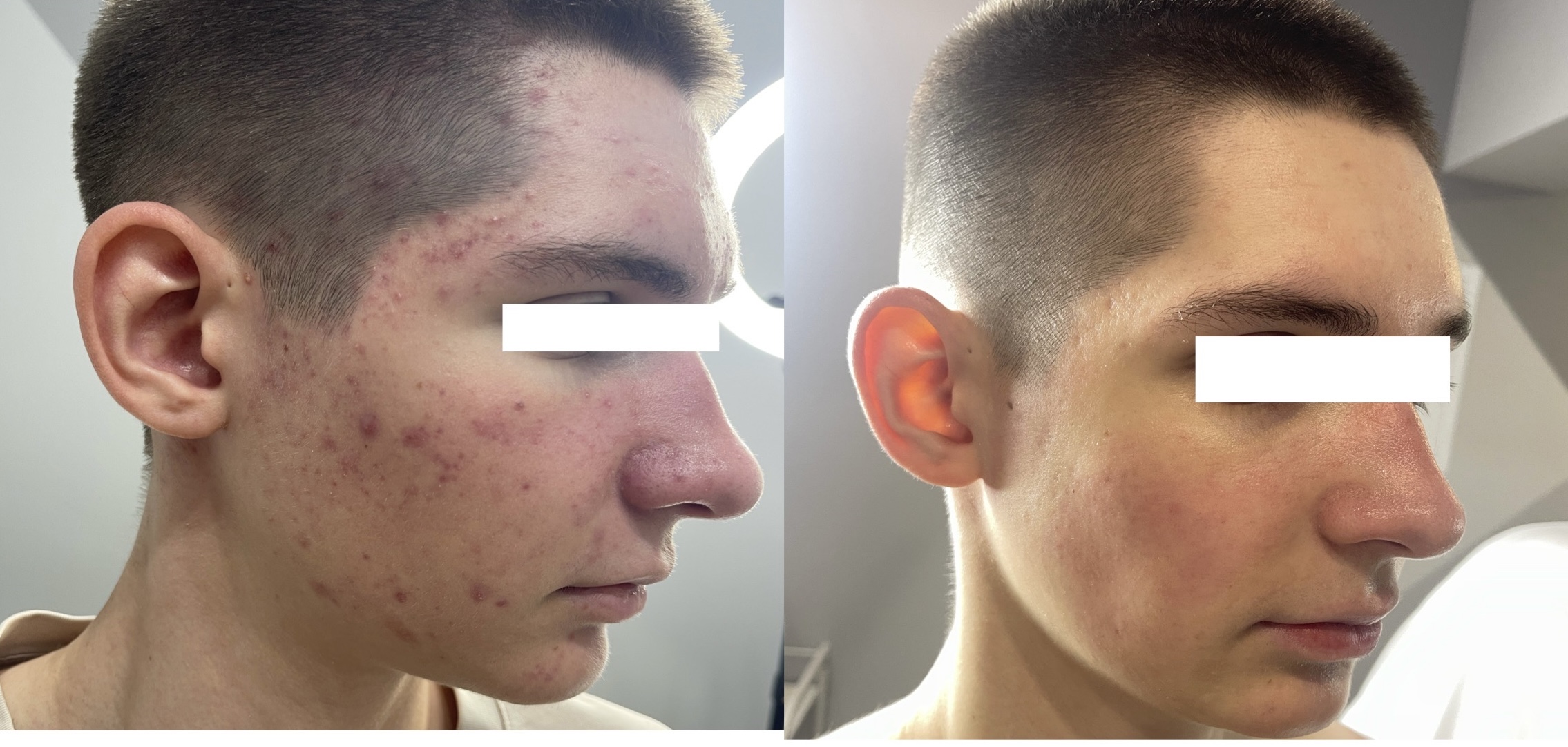 Пример работы Полины Жоголевой: сравнение фотографий 3
