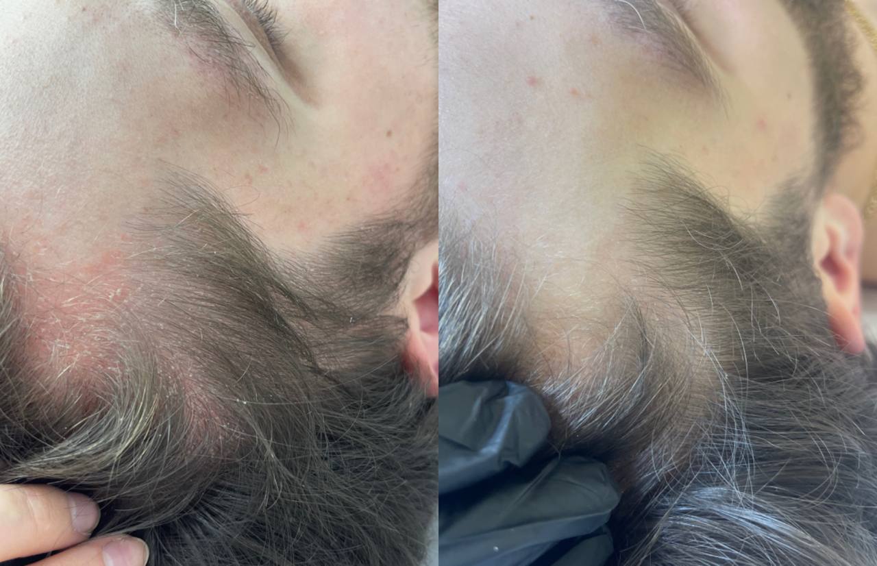 Пример работы Полины Жоголевой: сравнение фотографий 5